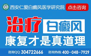 ÈçºÎ²é¿´Á³²¿°×°ßÊDz»Êǰ×ñ°·çÄØ