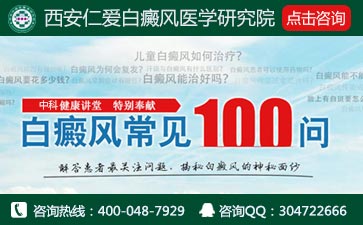 泛发型白癜风有什么典型特征