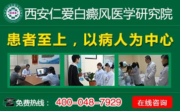 脚部白癜风该怎么护理